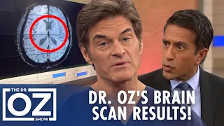 Dr. Oz Gets an MRI for His Old Football Concussions | Oz Health