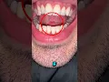 How to Gleek Techniques for Gleeking