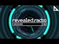 Download Lagu Revealed Radio 155 - Syzz