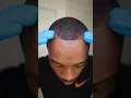 Download Lagu DAY 8 TRYING TO BRING MY HAIRLINE IN PT.2➿‼️💯