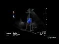 How to Measure A using PHT or Deceleration Time