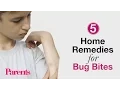 Home Remedies for Bug Bites Parents