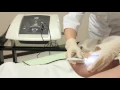 Електроепілятор на голках DA LIGHT 501 Classic needle