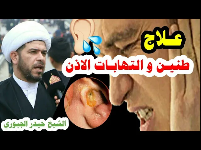 ⁣العلاج الأفضل والفعال للألتهابات وطنين الأذن للصغار والكبار