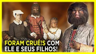 O Triste Casal da vida real que inspirou A Bela e a Fera