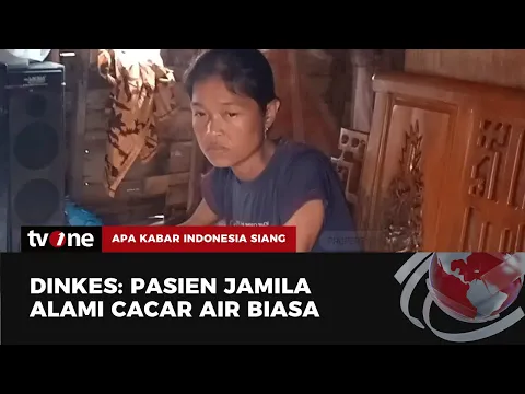 Sempat Tersuspek Cacar Monyet, Ternyata Warga Palembang Dinyatakan Negatif