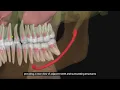 Ray 5D Keyfeature