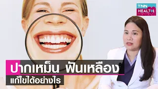 ทำไมบางครั้งฟันผุแล้วไม่รู้สึกเจ็บปวดเลย