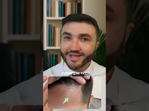NÃO FAÇA SEU TRANSPLANTE CAPILAR ANTES DE ASSISTIR A ESSE VÍDEO