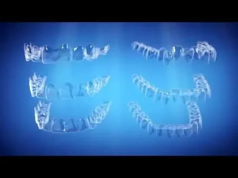 Straight Talk About Crooked Teeth: Invisalign