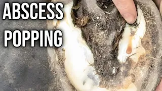 Painful Abscess Gets Popped