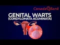 Genital Warts Explained HPV Diagnosis Treatment CanadaQBank
