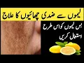 Download Lagu lemon se chaiyon ka elaj | remove pigmentation with lenom | لیموں سے چھائیوں کا علاج