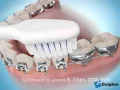 Dental Smiles of Willow Glen Presents How to Brush With Braces