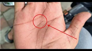 क्या आपके हाथ पर भी बन रहा है ऐसा भाग्यशाली क्रॉस, जानिए मतलब - संपर्क करें +917009126730