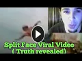 split face diving accident diving face split face split diving accident split face diving