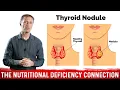 What s Behind Thyroid Nodules Thyroid Disorders Selenium Deficiency - Dr Berg