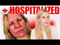 Skin Cancer Treatment Levulan Blue Light Photodynamic Therapy My Full Experience