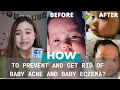 REMOVE BABY ACNE in just 3 DAYS REMOVE BABY ECZEMA MUSTELA STELATOPIA BABY PRODUCTS Paula C