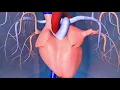 Catheter Ablation What is it and how does it help an irregular heart beat