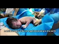 Download Lagu #newborns #baby #pregnant women giving birth#multiple births#twin#新生儿