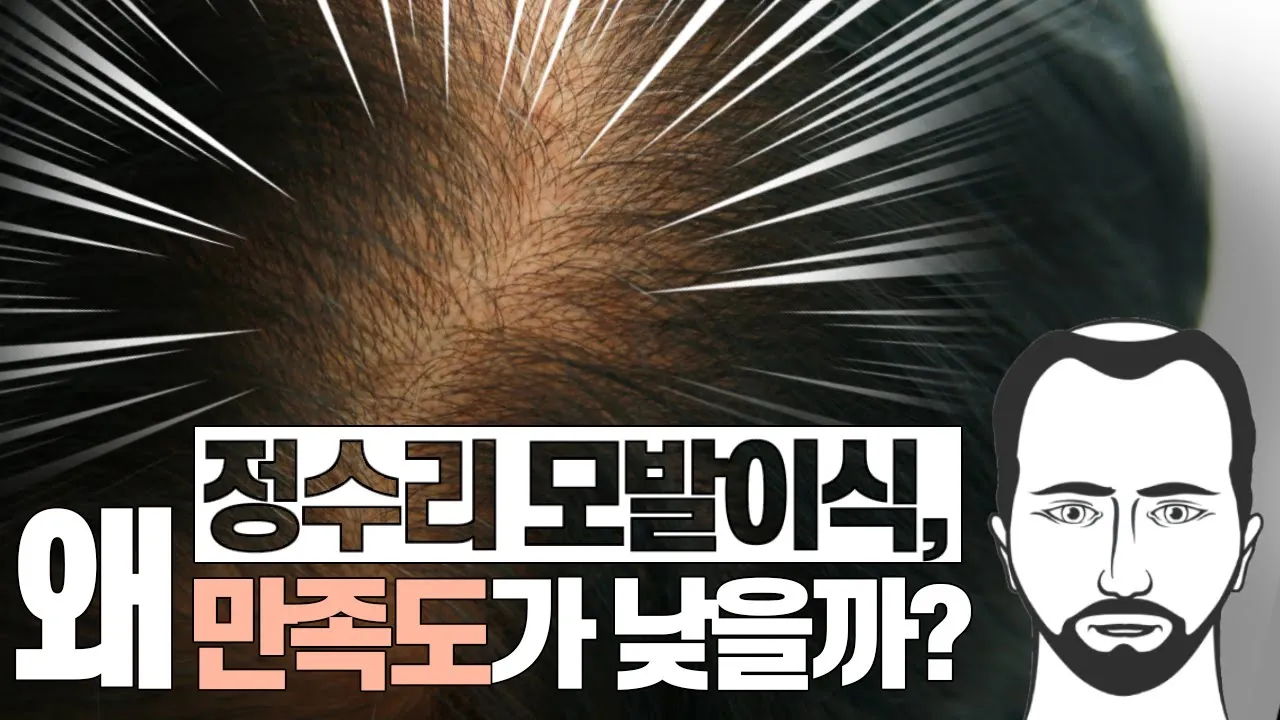 의느님답변📂ㅣ같은 양, 같은 밀도로 심었는데, 도대체 왜?
