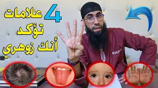أربع 4 علامات إذا كانو فيك فاعلم أنك زوهري فاحذر أن تفضح نفسك 