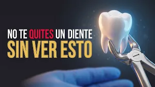 Haz esto ANTES de quitarte un diente y ahorra MUCHO DINERO 💰😱