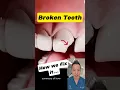 Download Lagu Broken Front Tooth? Here’s How Dentists Restore Your Smile! #dentallan #dentist #shorts