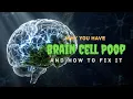 Stop Trying to Focus Do This Instead The 250 Dopamine Hack No Drugs Required