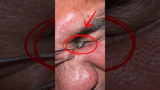 لحظة خروج كائن غريب من العين الكاميرا وث قت كل حاجة Shorts 