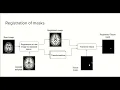 7 0 - MRI image registration of masks