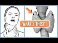 10 Warning Signs of Thyroid Cancer