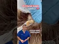 Download Lagu Pilar cyst removal #skincare LIPOMACYST clinic