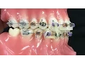 Triangle Elastics