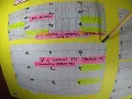 TAG-1A LATERAL STEMI