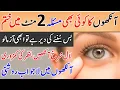 Download Lagu The Treatment For The Diseases Of Eye | Ankh Ki Bimari Ka Quran Se Ilaj | Wazifa For Eye Disease
