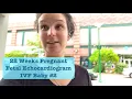 IVF BABY FETAL ECHOCARDIOGRAM Danielle Serrano