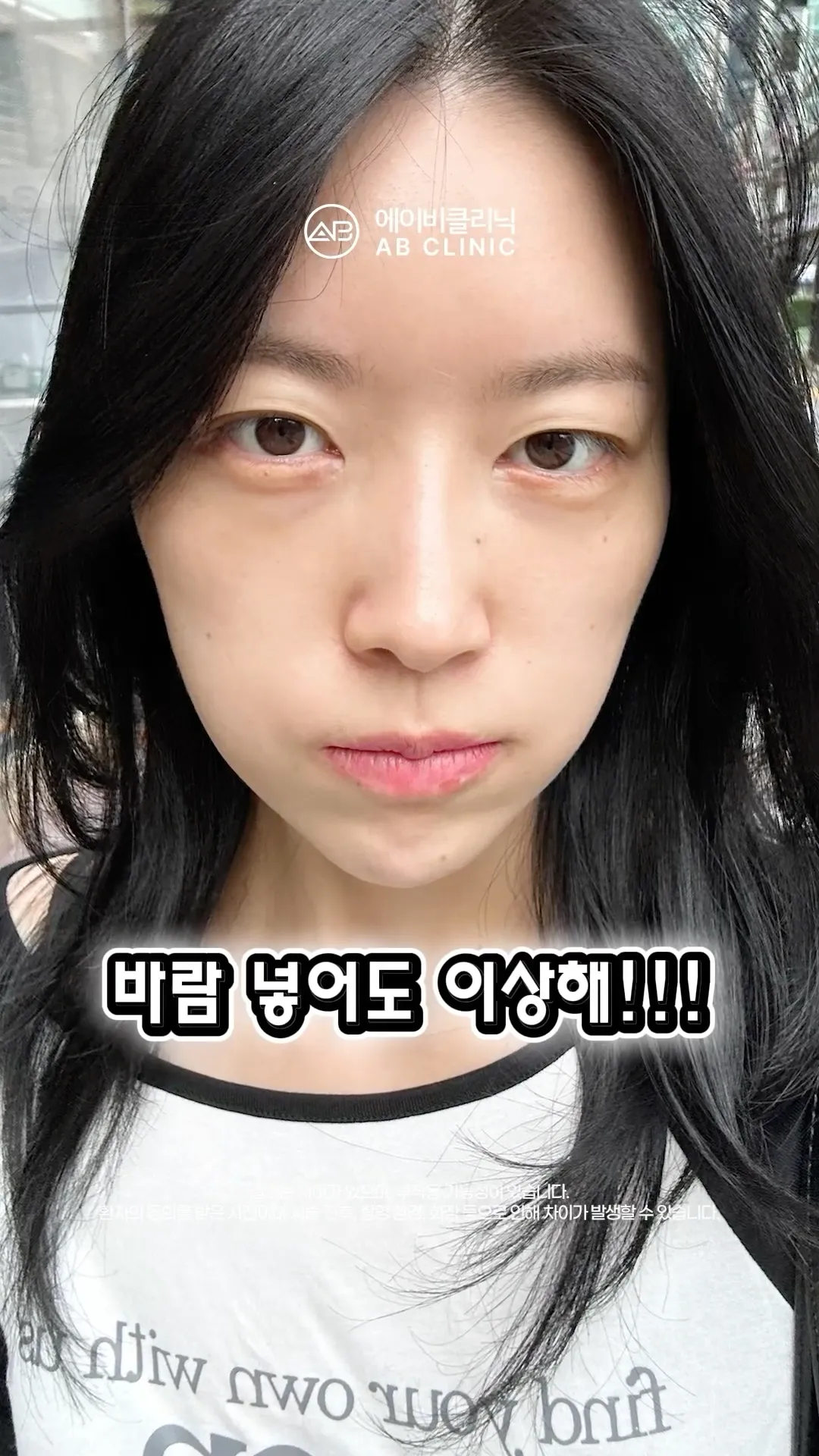 바람빠진 얼굴, 볼륨 채워넣기🎈