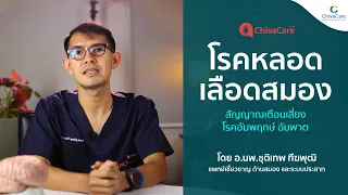 การรักษาหลอดเลือดสมองตีบในระยะเฉียบพลันมีวิธีใดบ้าง