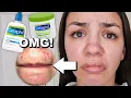 I Used Cetaphil Skincare For One Week