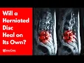Will a Herniated Disc Heal on Its Own SURPRISING ANSWER