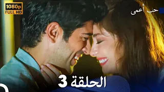 حب أعمى الحلقة 3 Arabic Dubbed 