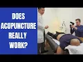 DOES ACUPUNCTURE REALLY WORK
