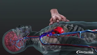 CPR In Action A 3D Look Inside The Body 