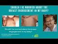 Download Lagu Should I be worried about the breast engorgement in my baby? #Neonatal mastitis #breastenlargement