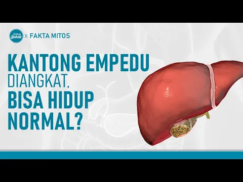 Kantong Empedu Sudah Diangkat, Bisakah Hidup Normal?