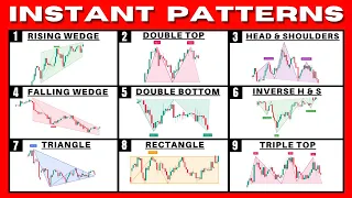 Find WINNING Chart Patterns With Just One Click! (This Is Unfair…..)
