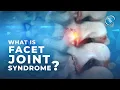 What is Facet Joint Syndrome