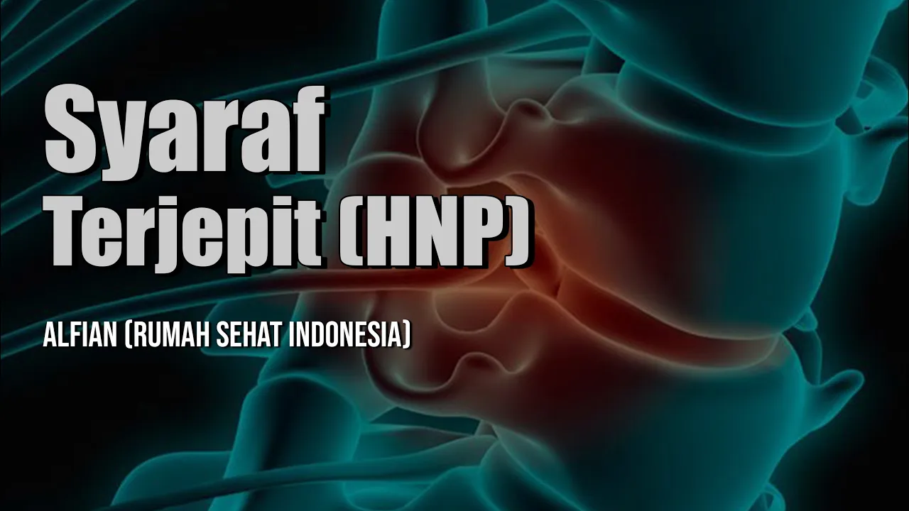 Atasi HNP dengan Laser PLDD [Hanya 15 Menit] ~-~~-~~~-~~-~-~-~~-~~~-~~-~-~ Lamina Pain & Spine Cente. 